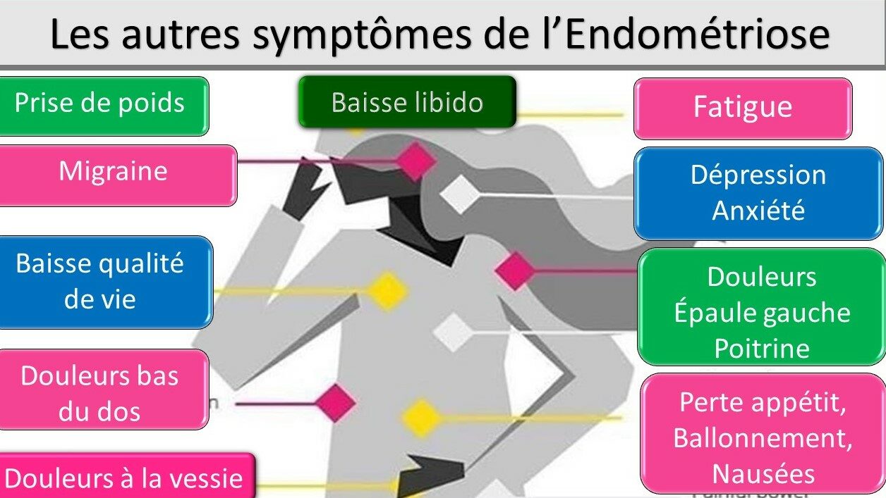 illustration des symptômes de l endométriose